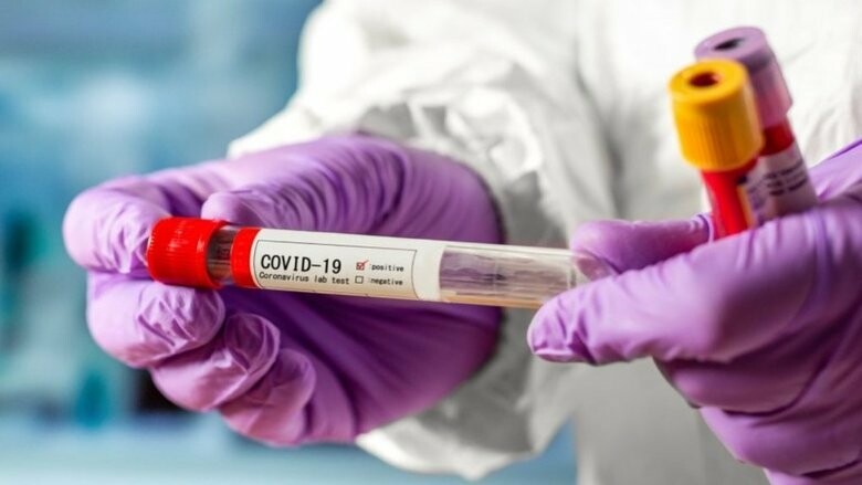 COVID-19 в Україні: статистика за 25 жовтня по областях