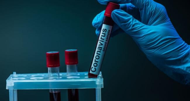 В Україні за минулу добу зафіксовано 4 984 нових випадків коронавірусної хвороби