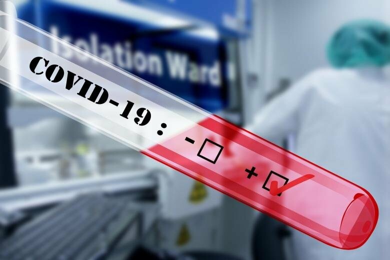 Статистика по COVID-19 в Україні: за добу зафіксовано 1 334 нових випадки коронавірусу